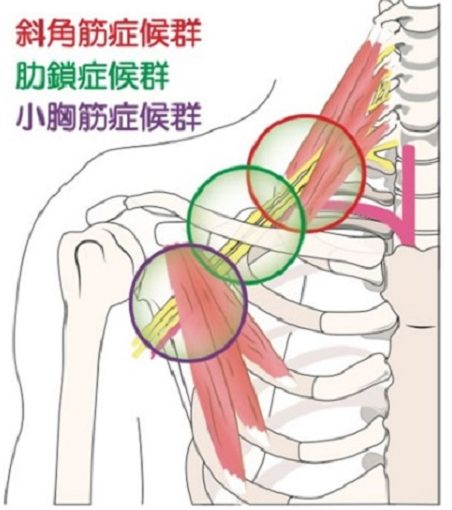 痛い が 肋骨 あいだ の 左の肋骨の下の痛み：何が痛い？ 左肋骨の下の痛み